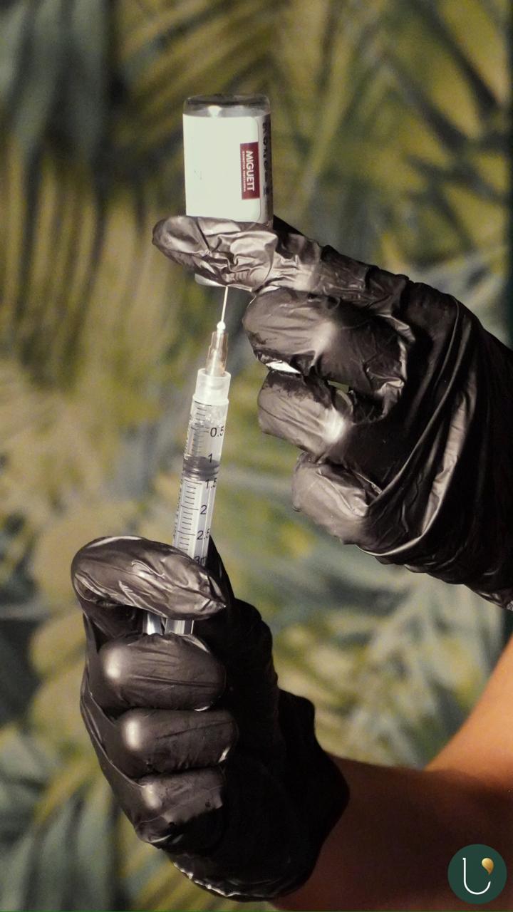 Regeneración capilar con dermapen y PDRN