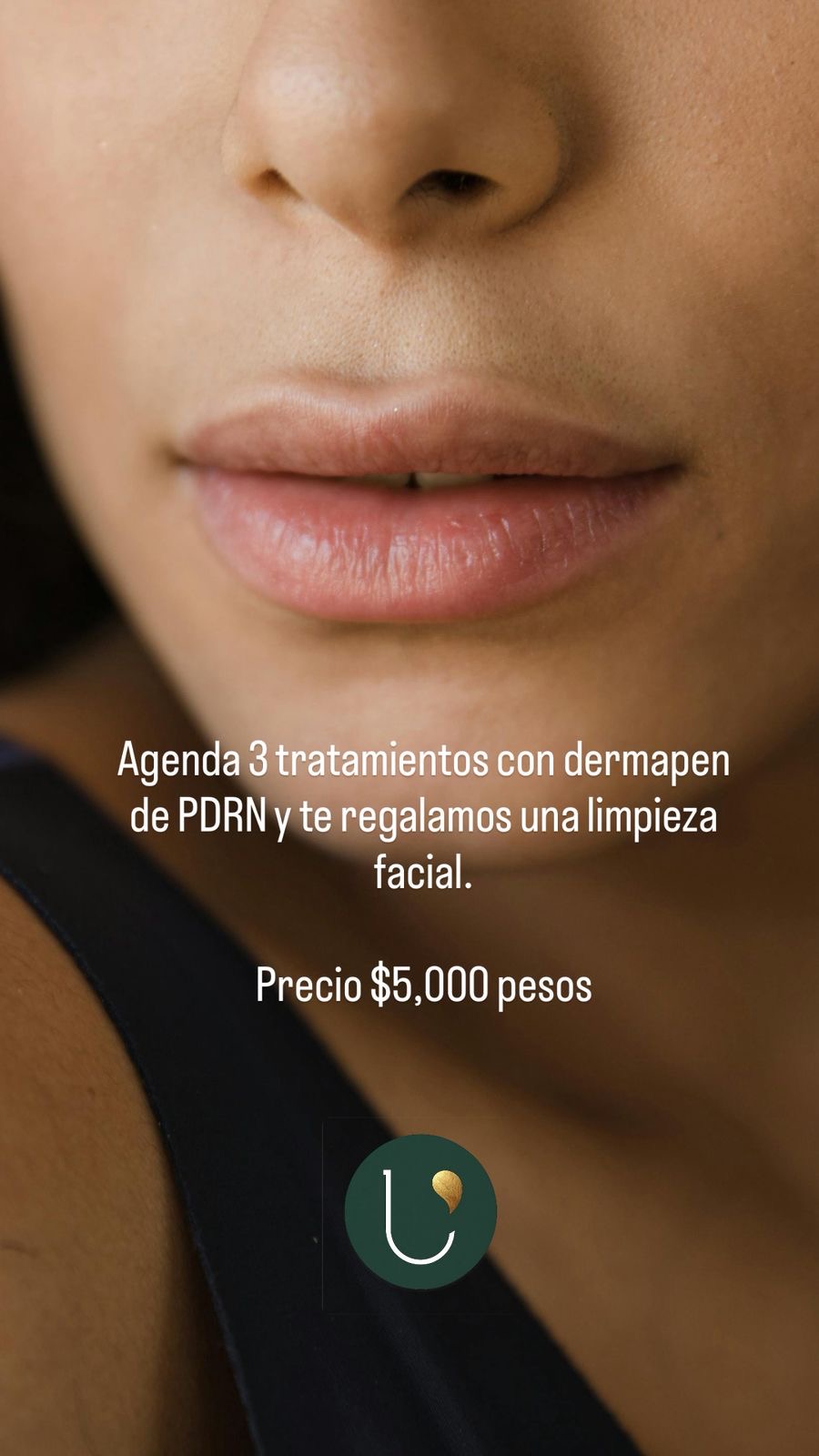 3 sesiones de dermapen